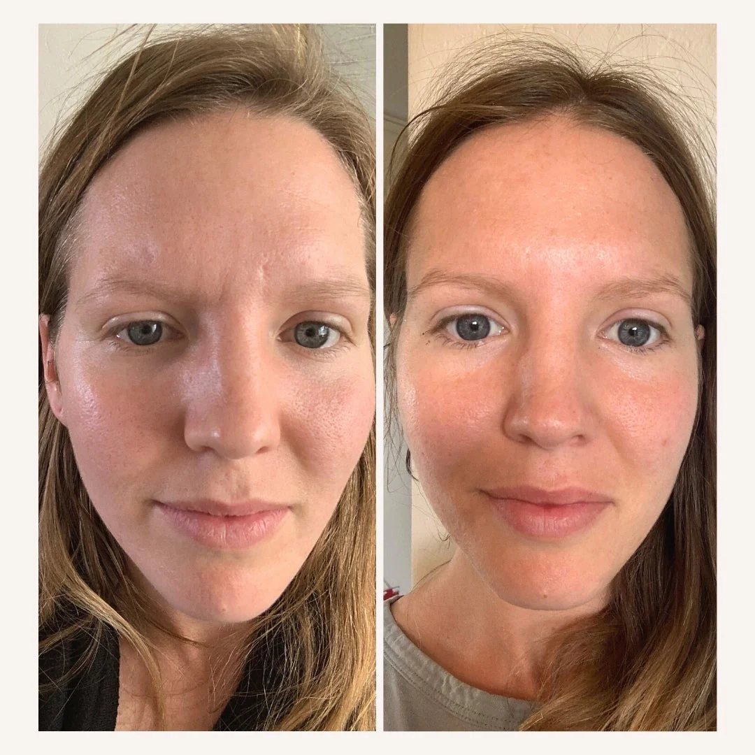 collagen